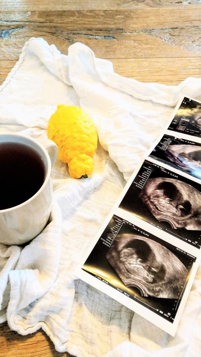 Mein persönliches Schwangerschaftsupdate: Die 14. Schwangerschaftswoche. Wie geht es mir in der Schwangerschaft? Was macht der Bauch? Gibt es Veränderungen? 